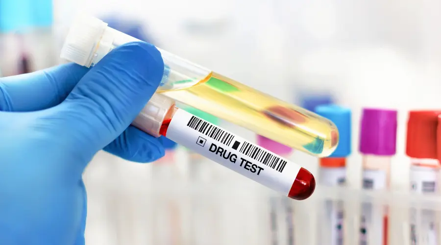 Blood Test