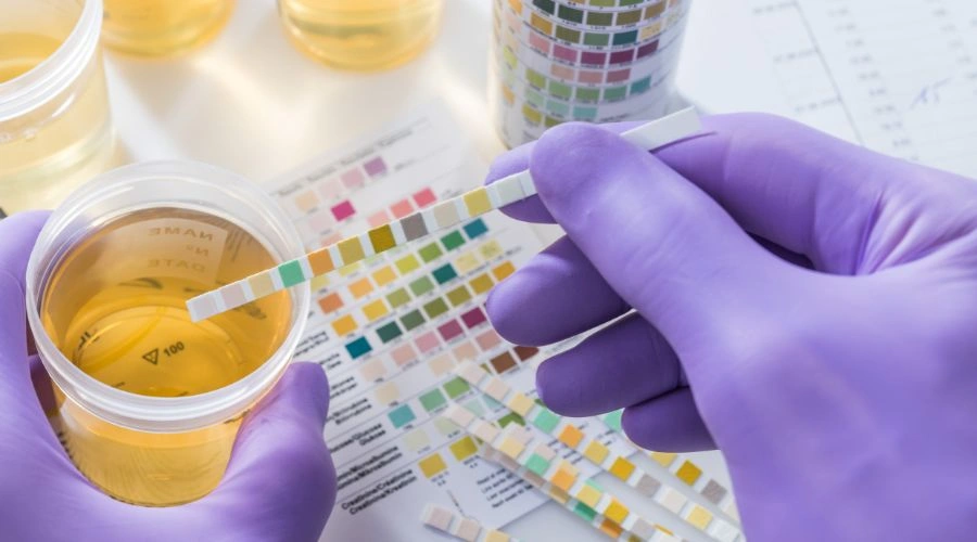 Can You Pass an EtG Test in 48 Hours?