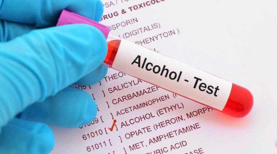 EtG Alcohol Test Window for Positive Results
